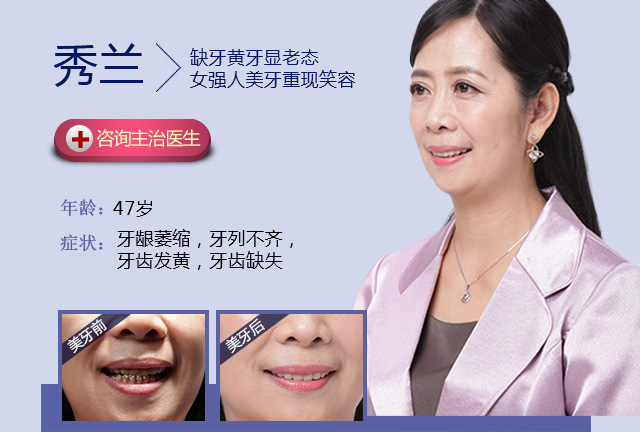 牙齿美容修复真人案例