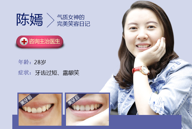 牙齿美容修复真人案例