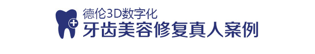 牙齿美容修复真人案例