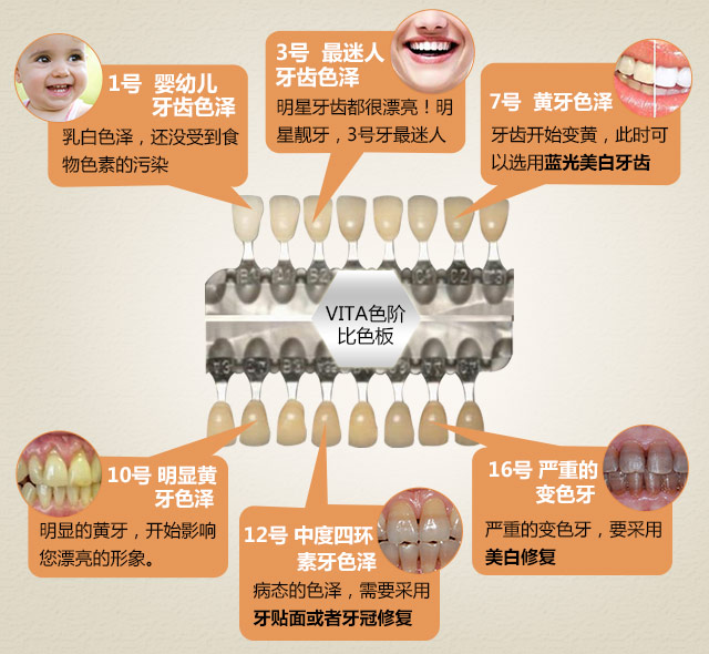 牙齿色阶