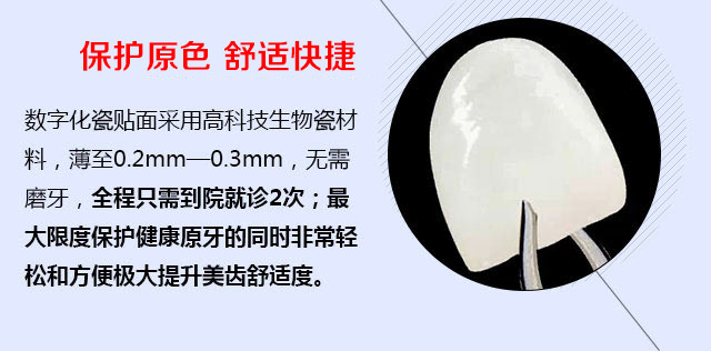 数字化瓷贴面舒适快捷